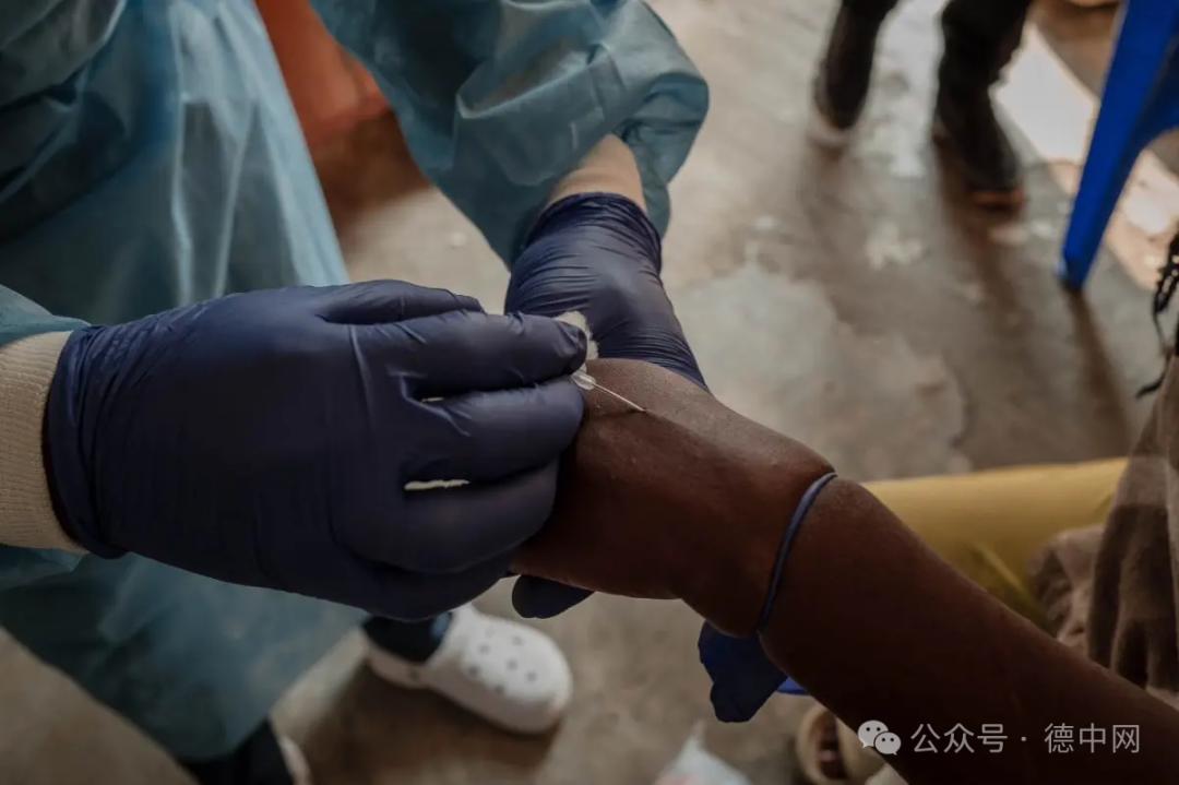 巴基斯坦发现猴痘病例,欧洲被警告做好准备-ichn.eu | 人在欧洲